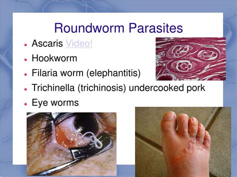 Ppt Roundworms Phylum Nematoda Powerpoint Presentation Free