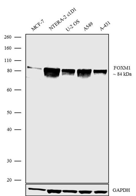 Foxm1 Antibody 702664 In Wb Thermo Fisher Scientific Kr