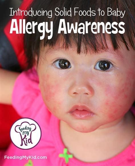 Understanding Baby Food Allergies Baby Food Allergies Baby Food