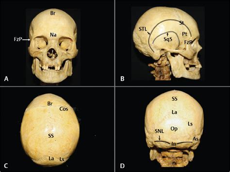 Anatomical Landmarks And Cranial Anthropometry Neupsy Key