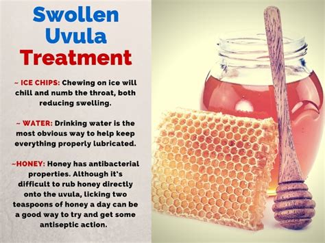 Swollen Uvuala Uvulitis Causes Symptoms And Treatment