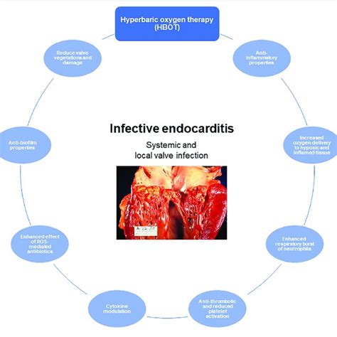 Biofilm Characteristics In Infective Endocarditis Ie Download