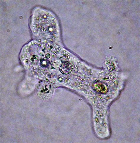 Amoeba Found In Water Collected From A Pond In A Disused Quarry On The