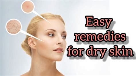 Easy Remedies For Dry Skin By Great Tips Effective Home Remedies