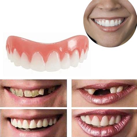 1pc Professional Perfect Smile Veneers Dub Stock Correction Teeth Ebay