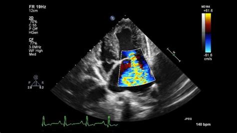 Maybe you would like to learn more about one of these? Echocardiography and Cardiovascular Imaging - NC State ...