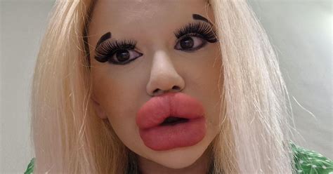 Woman With World S Biggest Lips Can T Find Love Of Her Life Despite Legions Of Fans World