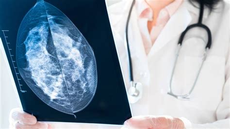 50 Of Women Had A False Positive Mammogram After 10 Years