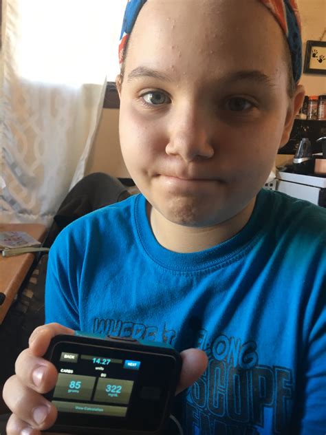 A Day In The Life Of A 10 Year Old T1d Wisconsin Chapter