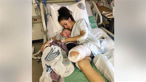 Mom Grateful To Be Alive After Losing Leg In Horror Motorcycle