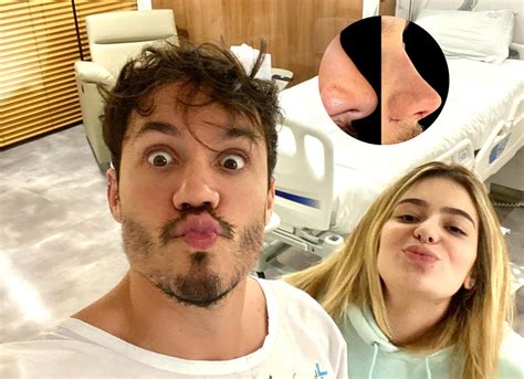 Eliezer Revela Resultado De Rinoplastia Era Um Sonho Antes E Depois