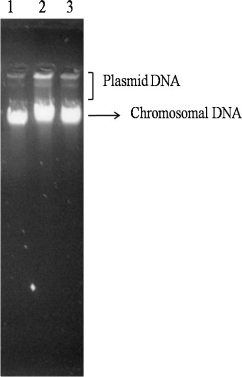 Electrophoresis Pattern Of Genomic Dna Of Clinically Chromosomal Dna