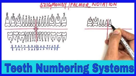 Tooth Numbering Systems Dental Notations Universal Palmers And Fdi