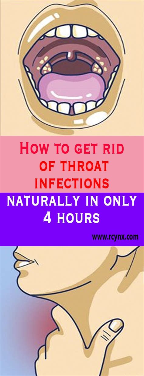 How To Get Rid Of Throat Infections Naturally In Only 4 Hours Throat Infection Natural Health