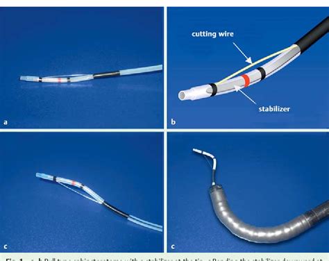 Figure 1 From Endoscopic Sphincterotomy Using A Pull Type