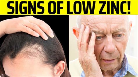 10 Signs Your Body Is Begging For Zinc Youtube