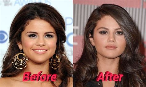 Selena Gomez Selena Gomez Hair Plastic Surgery Celebrity Plastic