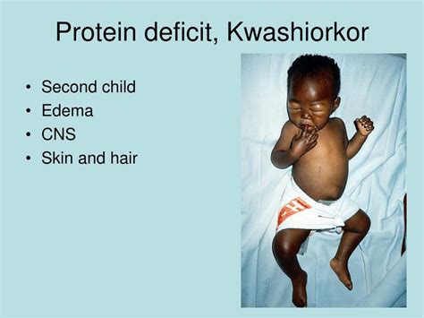 Ppt Environmental And Nutritional Diseases Powerpoint Presentation