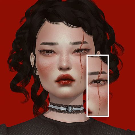 Sims 4 Scars And Wounds Hot Sex Picture