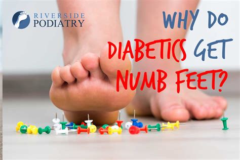 Why Do Diabetics Get Numb Tingling Burning Feet Riverside Podiatry