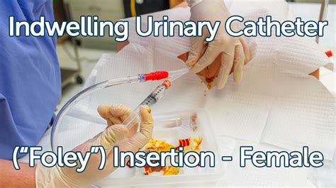 Female Foley Insertion Urinary Catheter How To Insert Nursing Skills Otosection