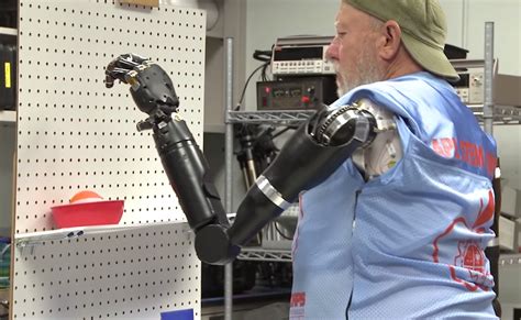 Marvel At Modern Science Man Uses Prosthetic Arms