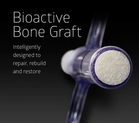 Bioactive Bone Graft Unite Foot And Ankle Development Site