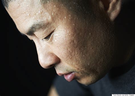 Excessive Sweating Linked To Mental Health | HuffPost Canada