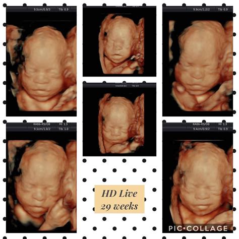 3d 4d Ultrasound Pictures