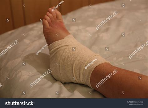 Bandaged Ankle Bruised Foot After Injury Stock Photo 1565953972