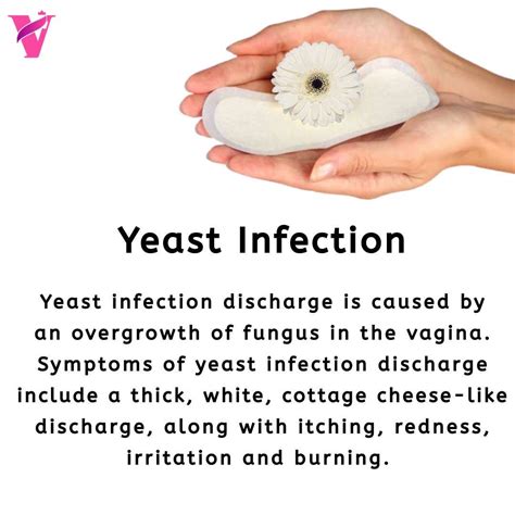 Cottage Cheese Discharge Yeast Infection