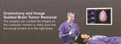 Image Guided Surgery Steps