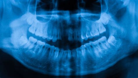 In particular you should try to avoid if you want to directly strengthen your tooth enamel, you should try to actively consume food that is rich in minerals. Regrow Teeth With Stem Cells - The life pile