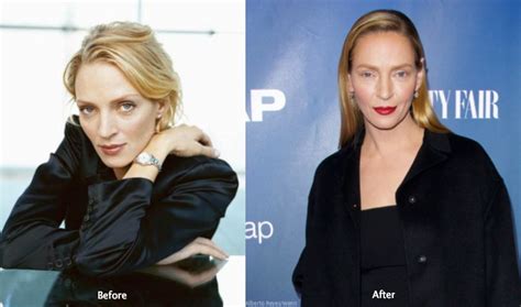 Uma Thurman Plastic Surgery Before And After Photos Latest Plastic