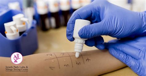 Instead, cats with extreme allergy symptoms typically get referred to a veterinary dermatologist. Immunotherapy Allergy | Testing | treatment in india