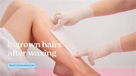 How To Prevent Ingrown Hairs After Waxing Using At Home