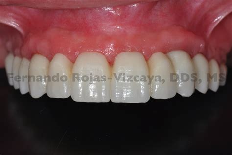 Simple Science: How to Make a Volcano with Kids