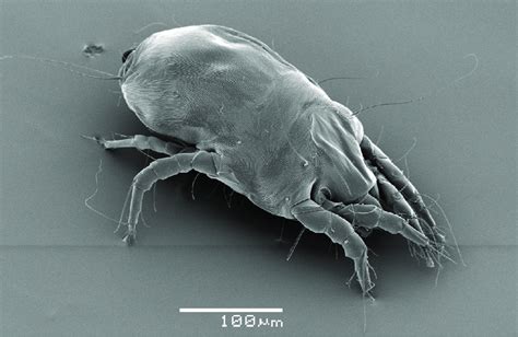 A Photograph Of A House Dust Mite Rita Walléncob Lund University