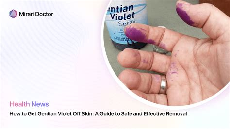 How To Get Gentian Violet Off Skin A Guide To Safe And Effective Removal