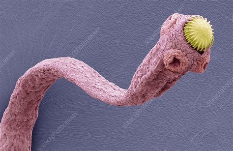 Tapeworm Sem Stock Image C0169076 Science Photo Library