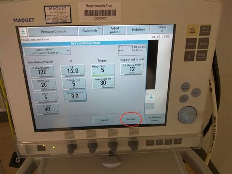 Tidal volume and respiratory rate set the minute ventilation. Setting up the Ventilator | Paediatric Emergencies