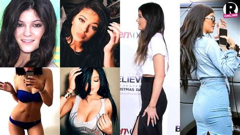 40K In Work Top Docs Reveal 17 Year Old Kylie Jenner S Boob Job Lip