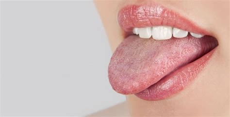 Red Spots On Tongue Causes Symptoms And Home Remedies