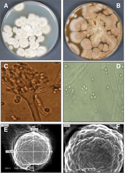 Macro And Microscopical Features Of Aspergillus Carneus Colonies After