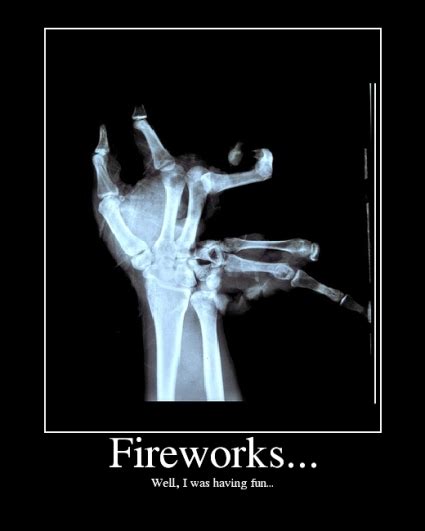 Fireworks Are Fun Just Dont Blow Your Fingers Off Pict