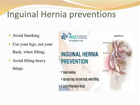 Ppt Inguinal Hernia Types Symptoms Diagnosis And Treatments