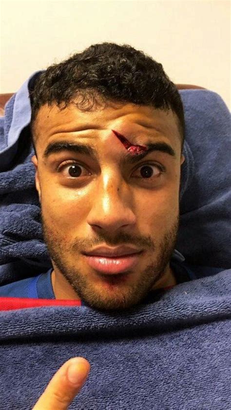 Rafinha alcântara psg, rafinha psg 2020, rafinha alcântara 2020, rafinha alcântara paris em entrevista exclusiva ao que partidazo, rafinha alcântara contou sobre a escolha de defender o. Imagem forte: Rafinha leva joelhada e fica com corte ...