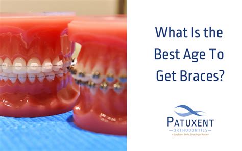 What Is The Best Age To Get Braces
