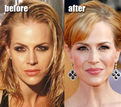 Julie Benz Plastic Surgery Before and After Botox, Hair ...