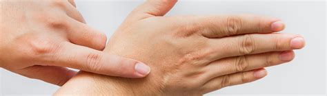 Qualot Hand Therapy Scar Management
